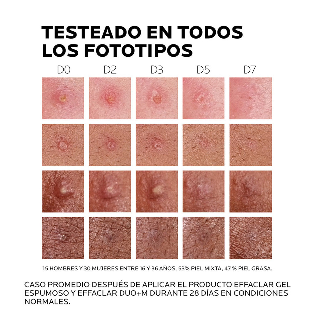 Effaclar Dúo +M